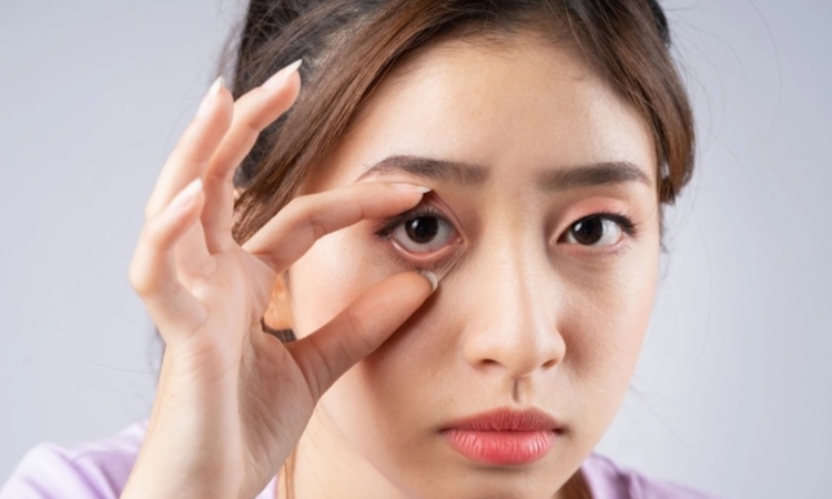 Kemenkes Catat Kebutaan Katarak Capai 650 Ribu Kasus di 2025,